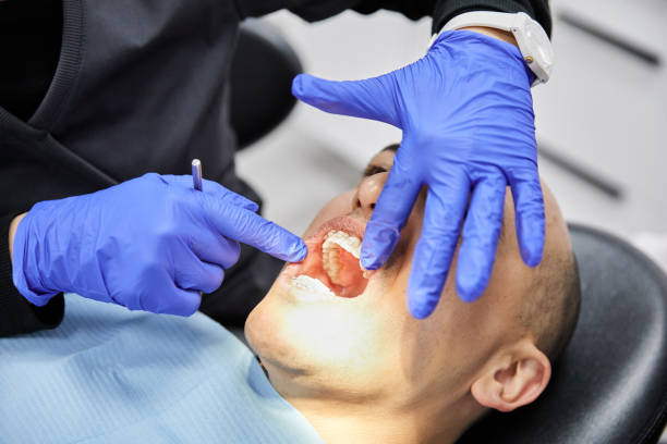 Best Emergency Tooth Extraction in Harrison, NJ