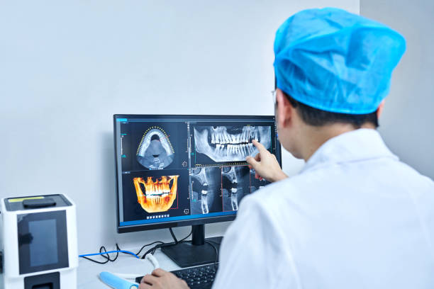 Best Emergency Dental Care for Broken or Chipped Teeth in Harrison, NJ