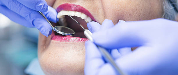 Best Emergency Treatment for Dental Infections or Abscesses in Harrison, NJ
